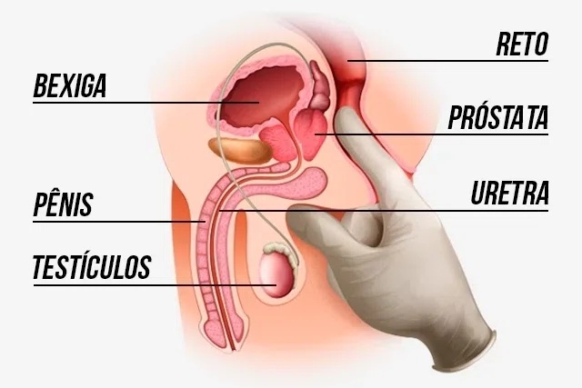 massagem-prostática